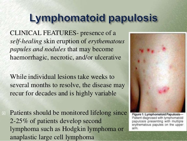 Cutaneous Lymphomas: Unusual Cases 2: v. 2